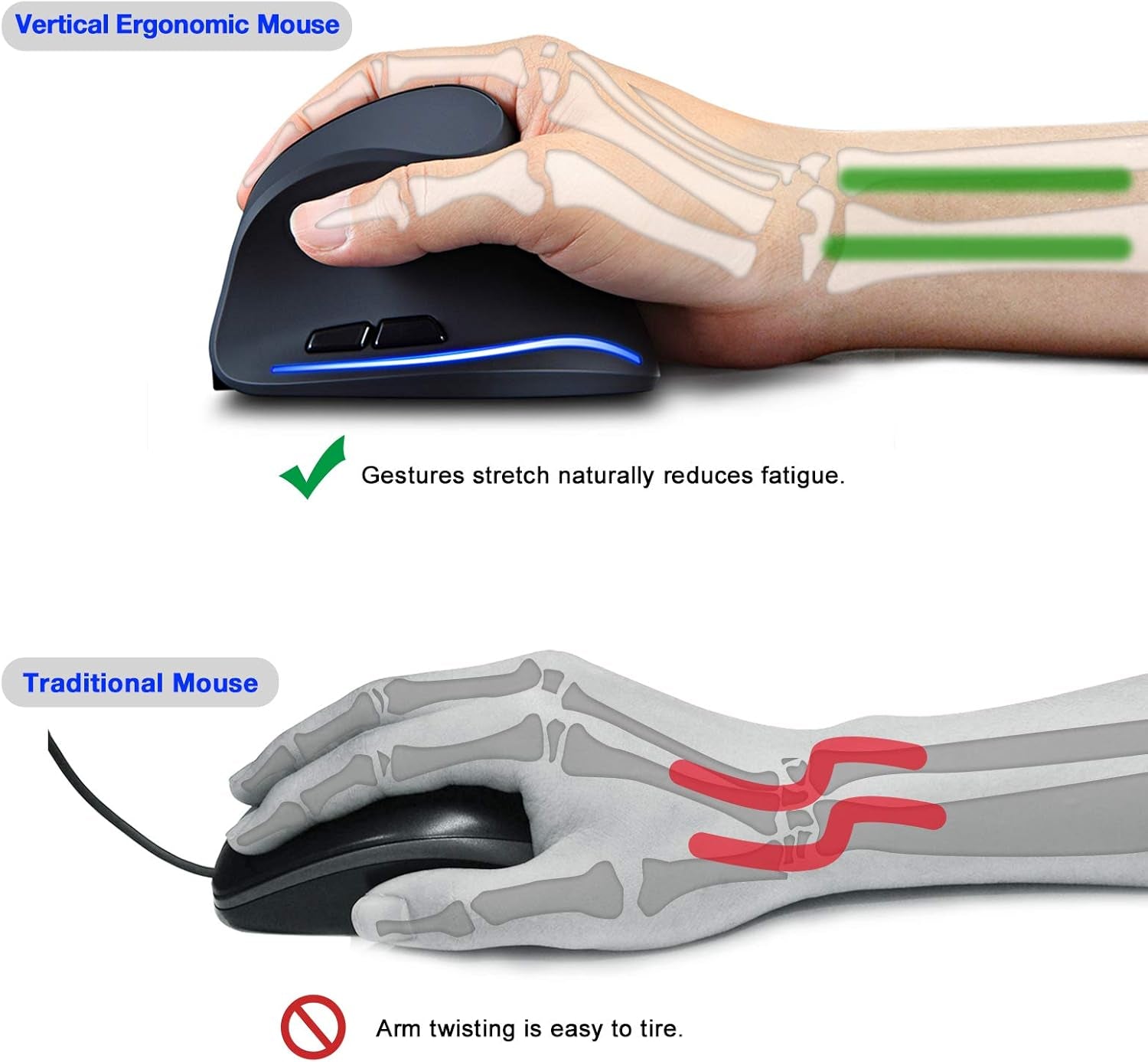 Ergonomic Mouse, 2.4G Wireless Vertical Optical Mouse with Adjustable Sensitivity (1000/1600/2400 DPI), 6 Buttons for PC, Desktop, Laptop, Notebook (Black)